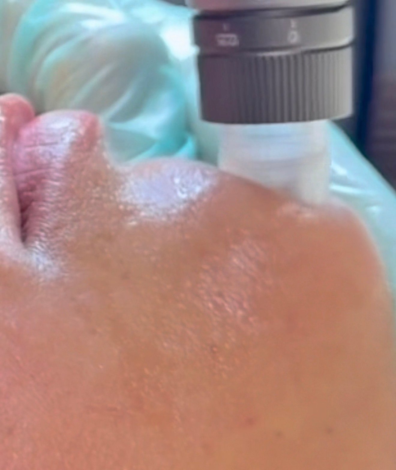 Professional Procedure